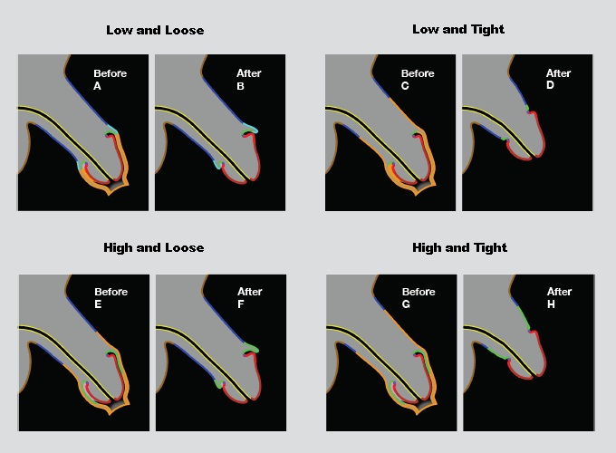 Cutting styles diagram showing high/low and tight/loose variations